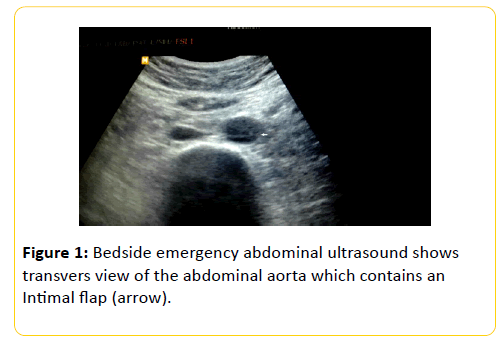 trauma-acute-care-Bedside-emergency