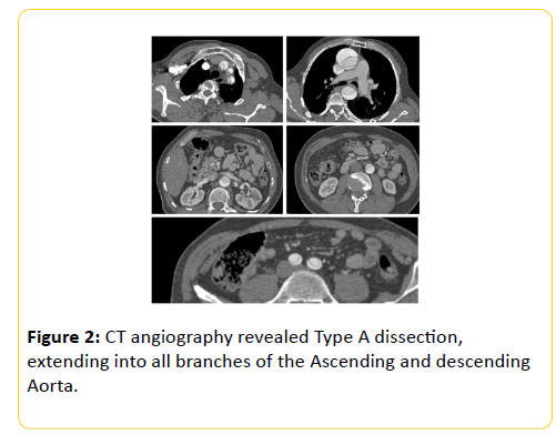 trauma-acute-care-CT-angiography