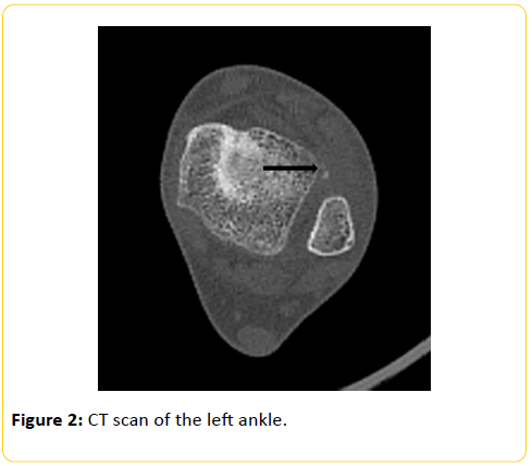 trauma-acute-care-CT-scan