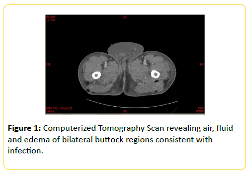 trauma-acute-care-Computerized-Tomography