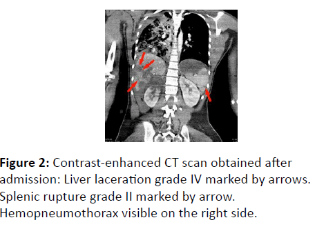 trauma-acute-care-Contrast-enhanced-CT