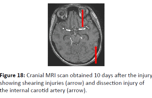 trauma-acute-care-Cranial-MRI-scan
