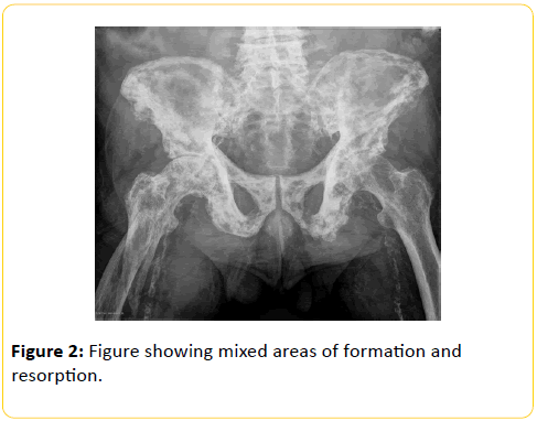 trauma-acute-care-Figure-showing