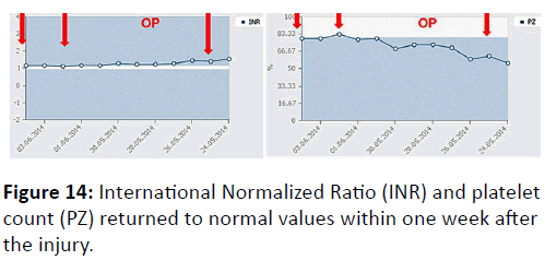 trauma-acute-care-International-Normalized-Ratio