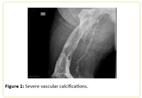 trauma-acute-care-Severe-vascular