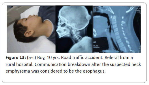 trauma-acute-care-accident