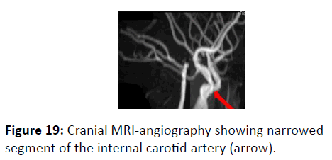 trauma-acute-care-angiography-showing