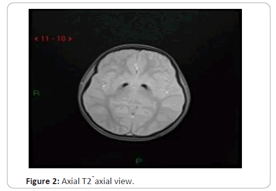 trauma-acute-care-axial