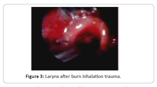 trauma-acute-care-burn