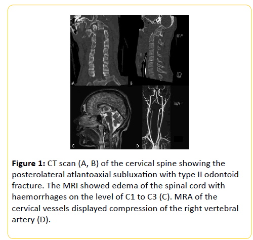 trauma-acute-care-cervical-spine