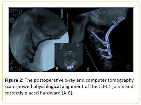 trauma-acute-care-computer-tomography