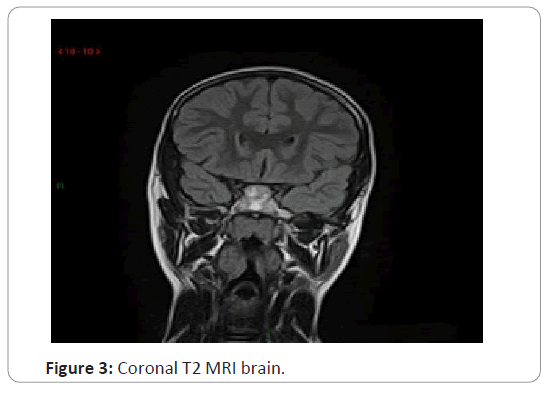 trauma-acute-care-coronal