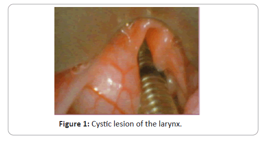 trauma-acute-care-cystic