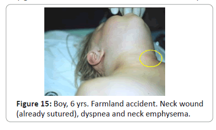 trauma-acute-care-farmland