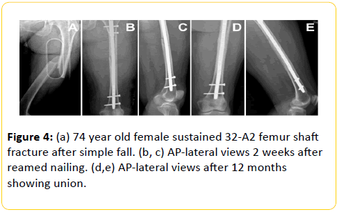 trauma-acute-care-female-sustained