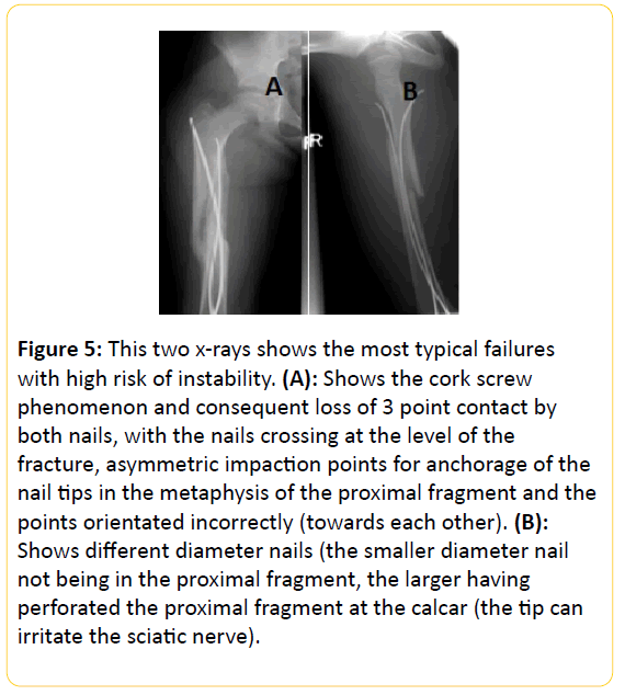 trauma-acute-care-high-risk-instability