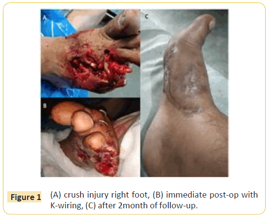 trauma-acute-care-immediate