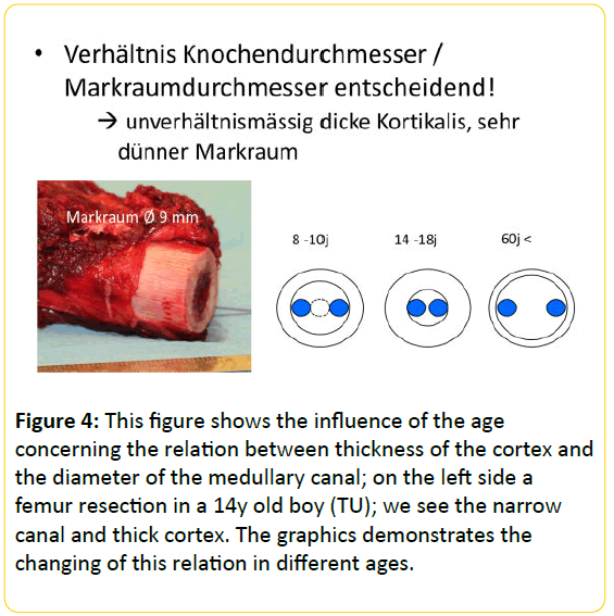 trauma-acute-care-influence-of-age