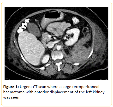 trauma-acute-care-large-retroperitoneal