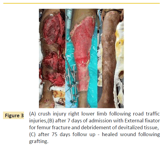 trauma-acute-care-lower