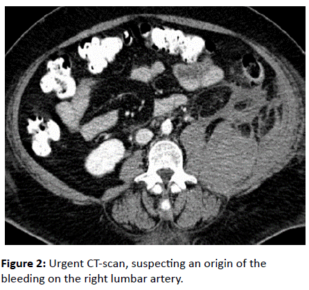 trauma-acute-care-lumbar-artery