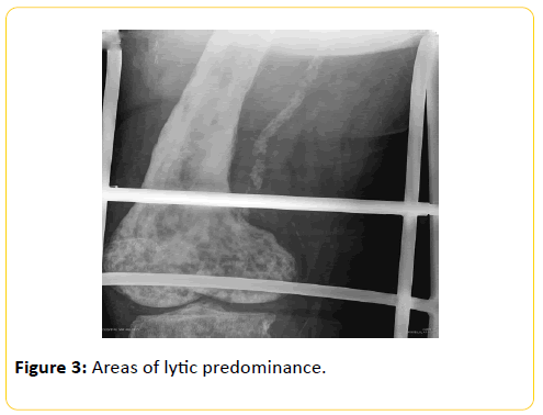 trauma-acute-care-lytic-predominance