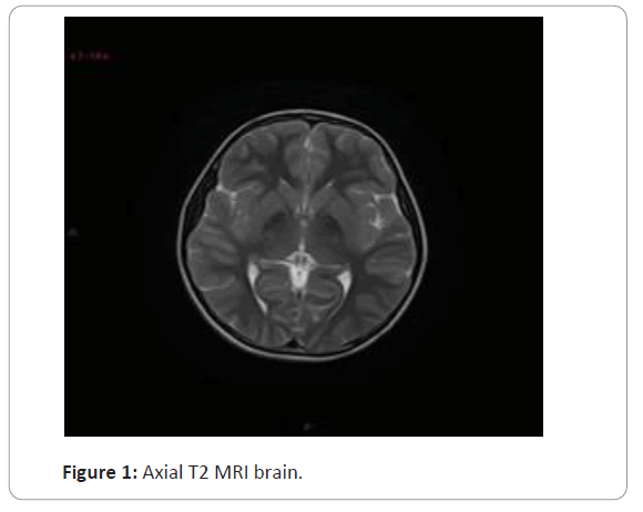 trauma-acute-care-mri