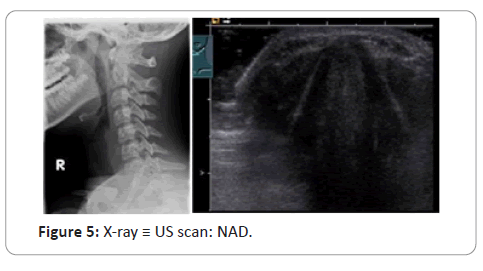 trauma-acute-care-scan