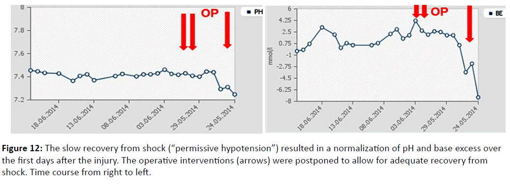 trauma-acute-care-slow-recovery-from-shock