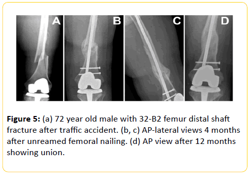 trauma-acute-care-traffic-accident