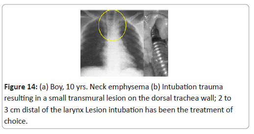 trauma-acute-care-trauma