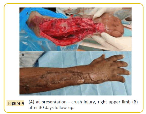 trauma-acute-care-upper