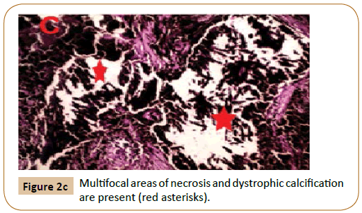 veterinary-medicine-and-surgery-Multifocal-areas-necrosis-dystrophic-calcification