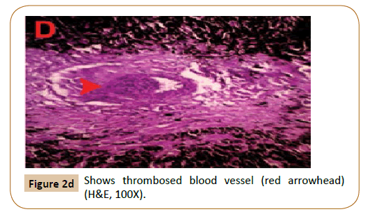 veterinary-medicine-and-surgery-thrombosed-blood-vessel