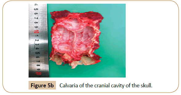 veterinary-medicine-surgery-Calvaria-cranial-cavity-skull