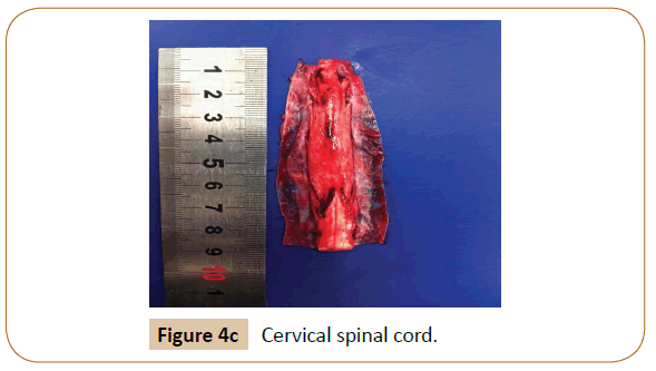 veterinary-medicine-surgery-Cervical-spinal-cord