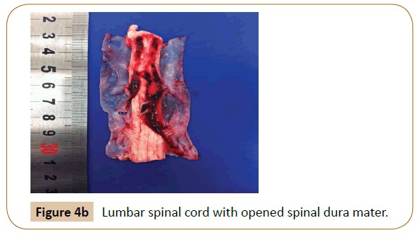 veterinary-medicine-surgery-Lumbar-spinal-cord