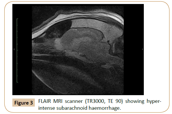 veterinary-medicine-surgery-hyperintense-subarachnoid-haemorrhage