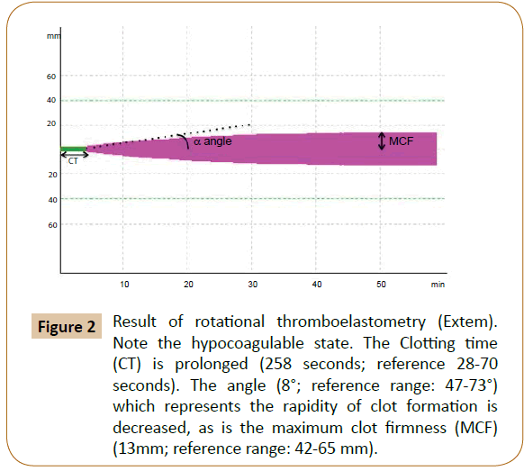 veterinary-medicined-surgery-rotational-thromboelastometry